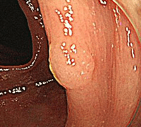 白色光通常観察