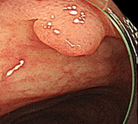 白色光通常観察