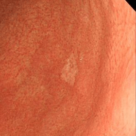 白色光通常観察の写真